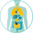 depiction of stage four of metastatic colorectal cancer 