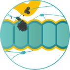 depiction of stage three of colorectal cancer